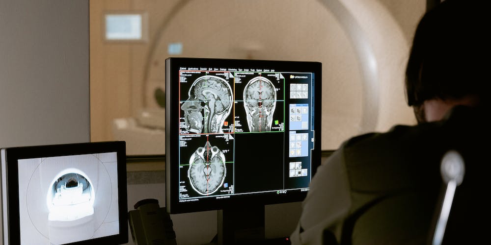 Medical Imaging The Advancements in Radiology Diagnostic Tools