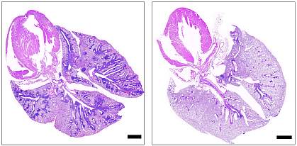 Cross-sections of lungs from mice with the gene deficiency that causes APS-1, showing damaged tissue in mice not administered ruxolitinib (left) and healthy tissue in mice administered ruxolitinib (right) Black bars represent 1 mm.