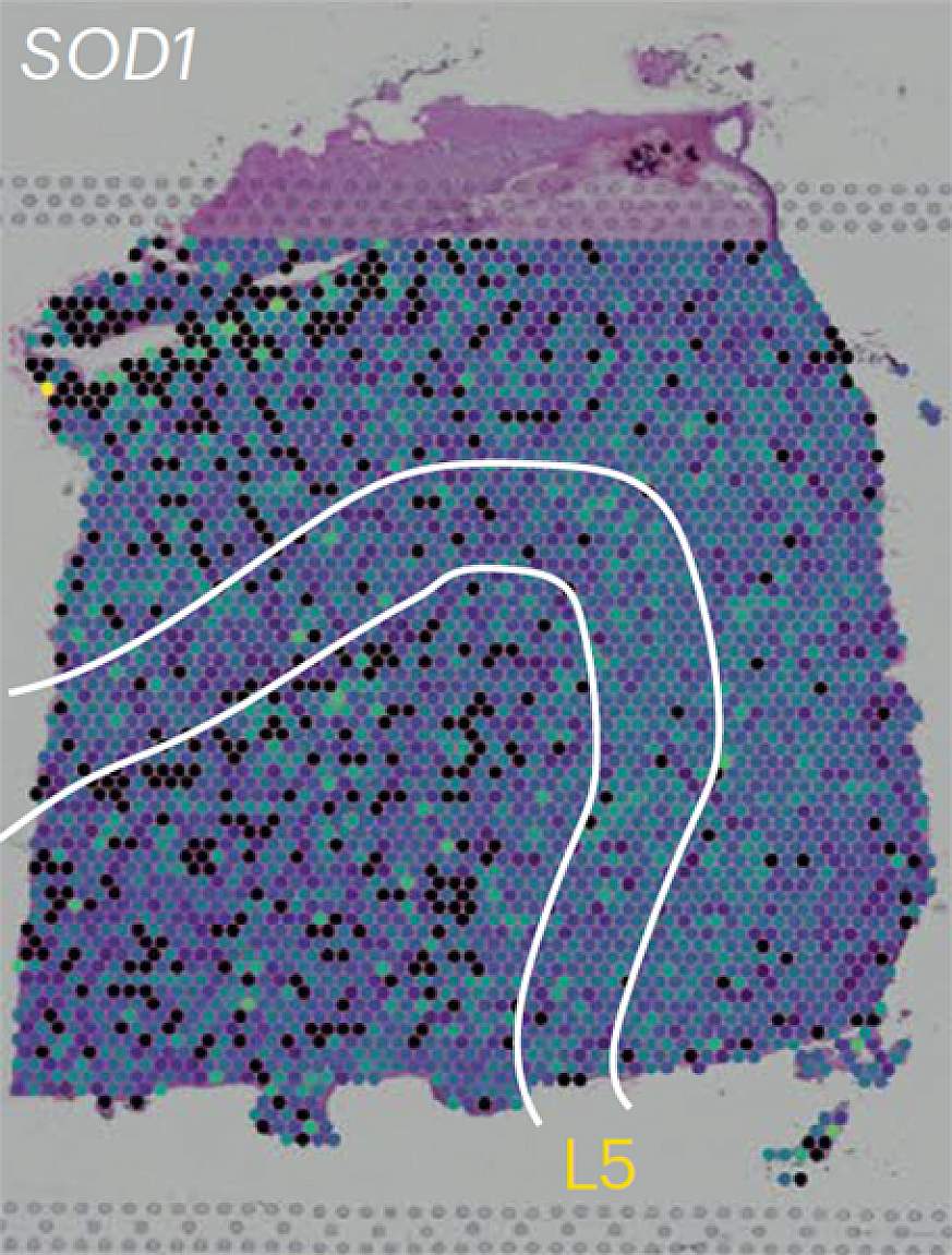 Map of gene expression levels in a sample of human brain tissue.