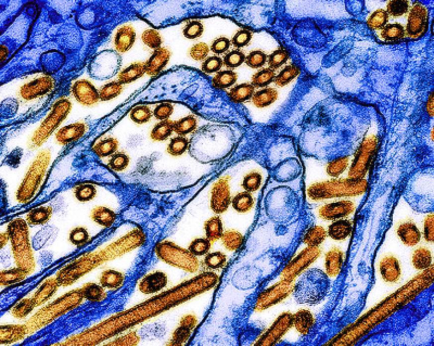 Scientific image of yellow and red round and tubular H5N1 virus particles