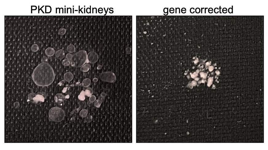 Two photos of tissue chips. The one on the left shows mini-kidneys with homozygous PKD mutations, the one on the right shows gene-corrected heterozygotes.