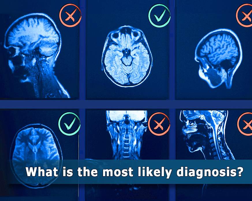 Image of six MRI scans with red Xs or green check marks and the question  - Which is the most likely diagnosis